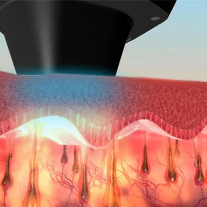 先进的冷却系统技术