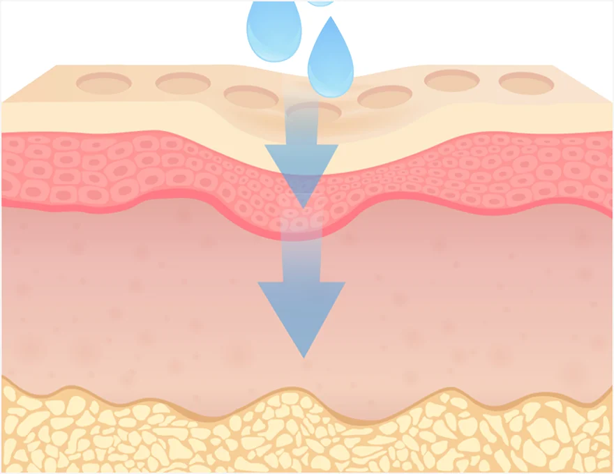 JUVELUX 程序 步骤 1 安全注射