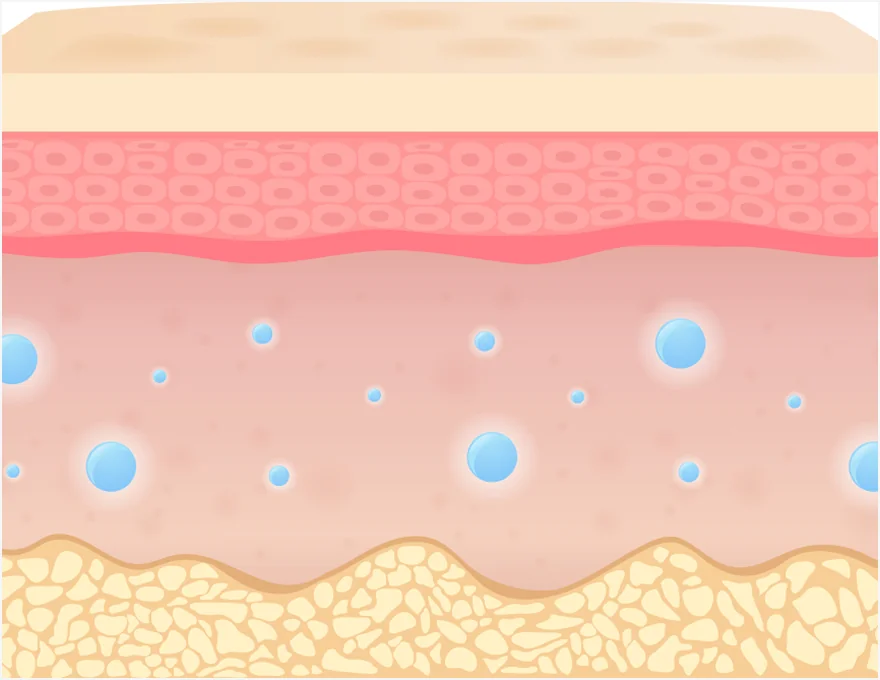 Retigen 治疗后皮肤更紧致
