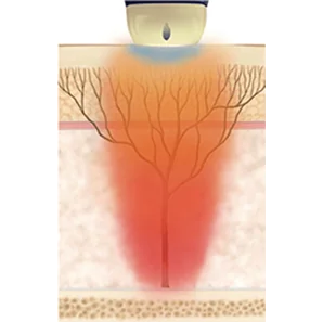 堆叠模式--强大的提升、紧致和亮白效果