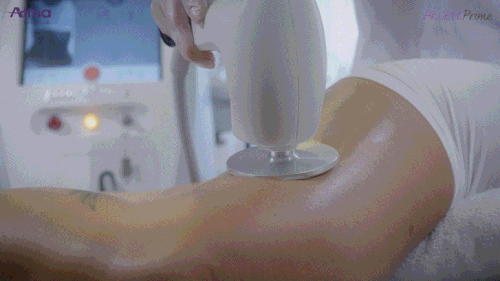 简单的无麻醉程序系统