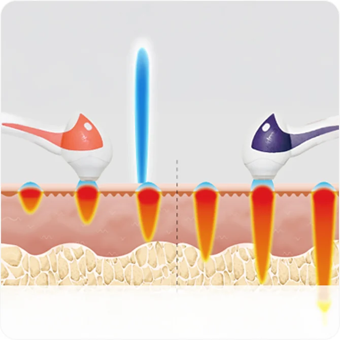 TuneFace 6 级深度调节定制护理