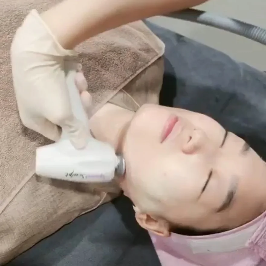 TuneLiner 20 分钟免麻醉治疗