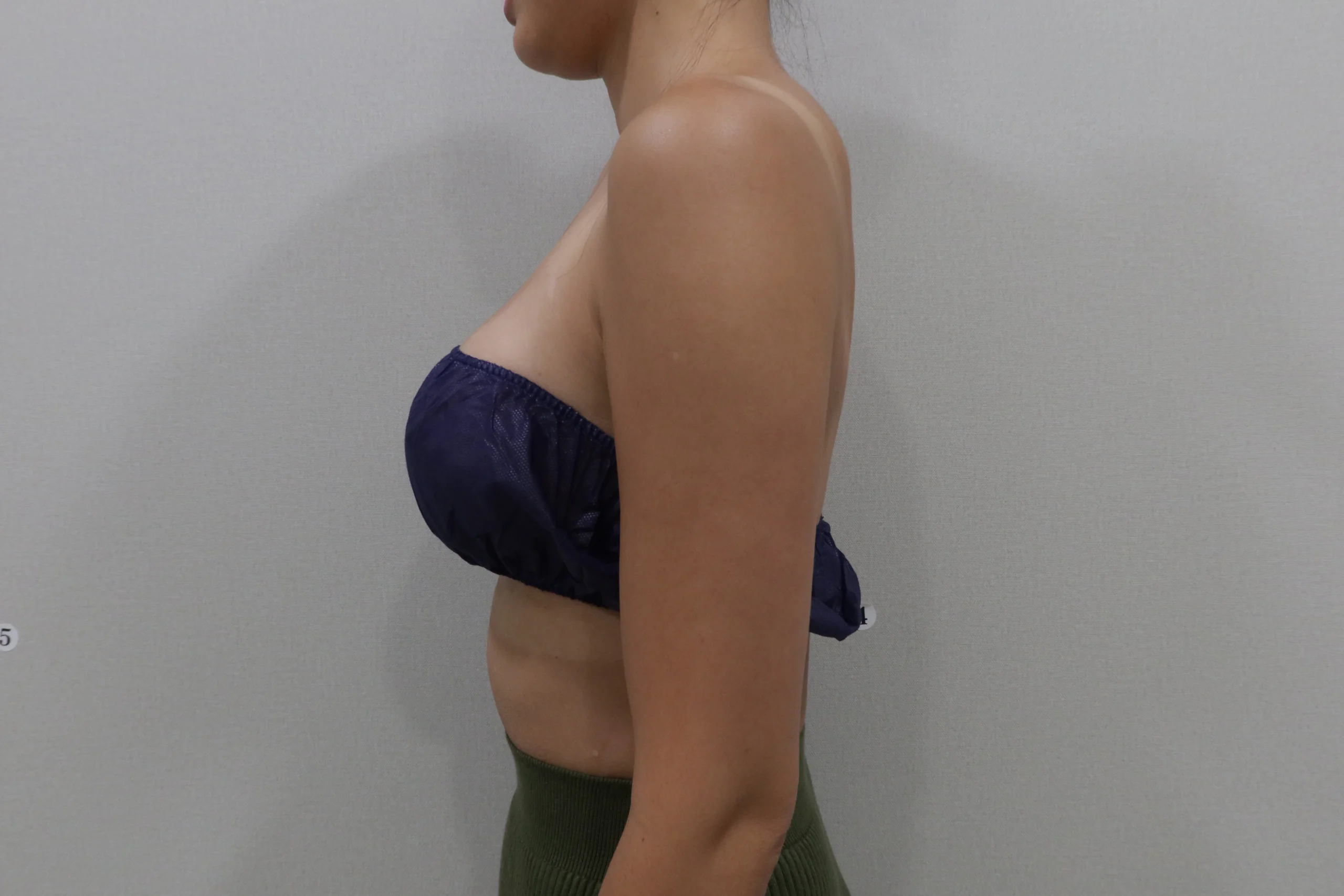 高级 TuneBody 前臂护理后