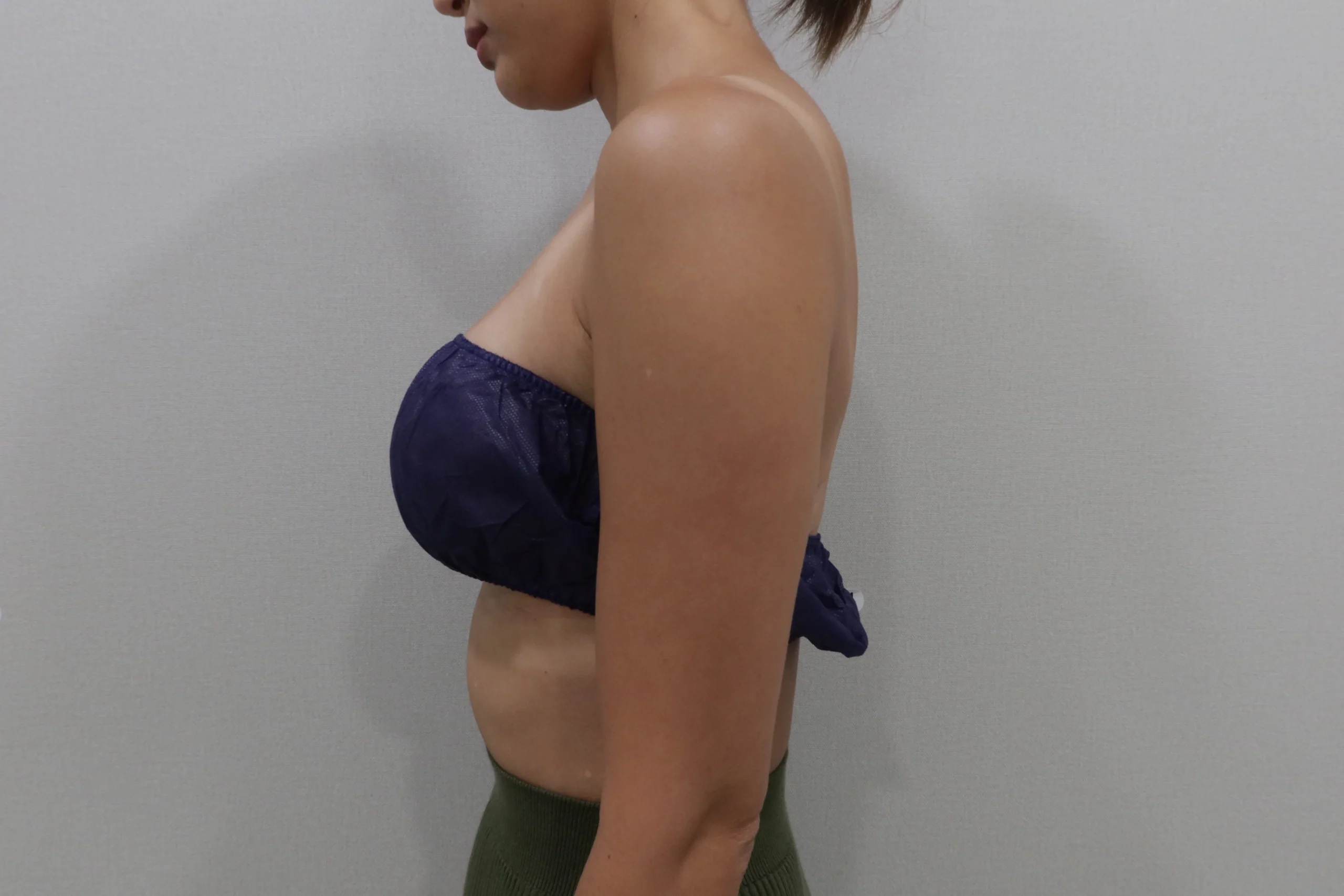 使用高级 TuneBody 前臂前