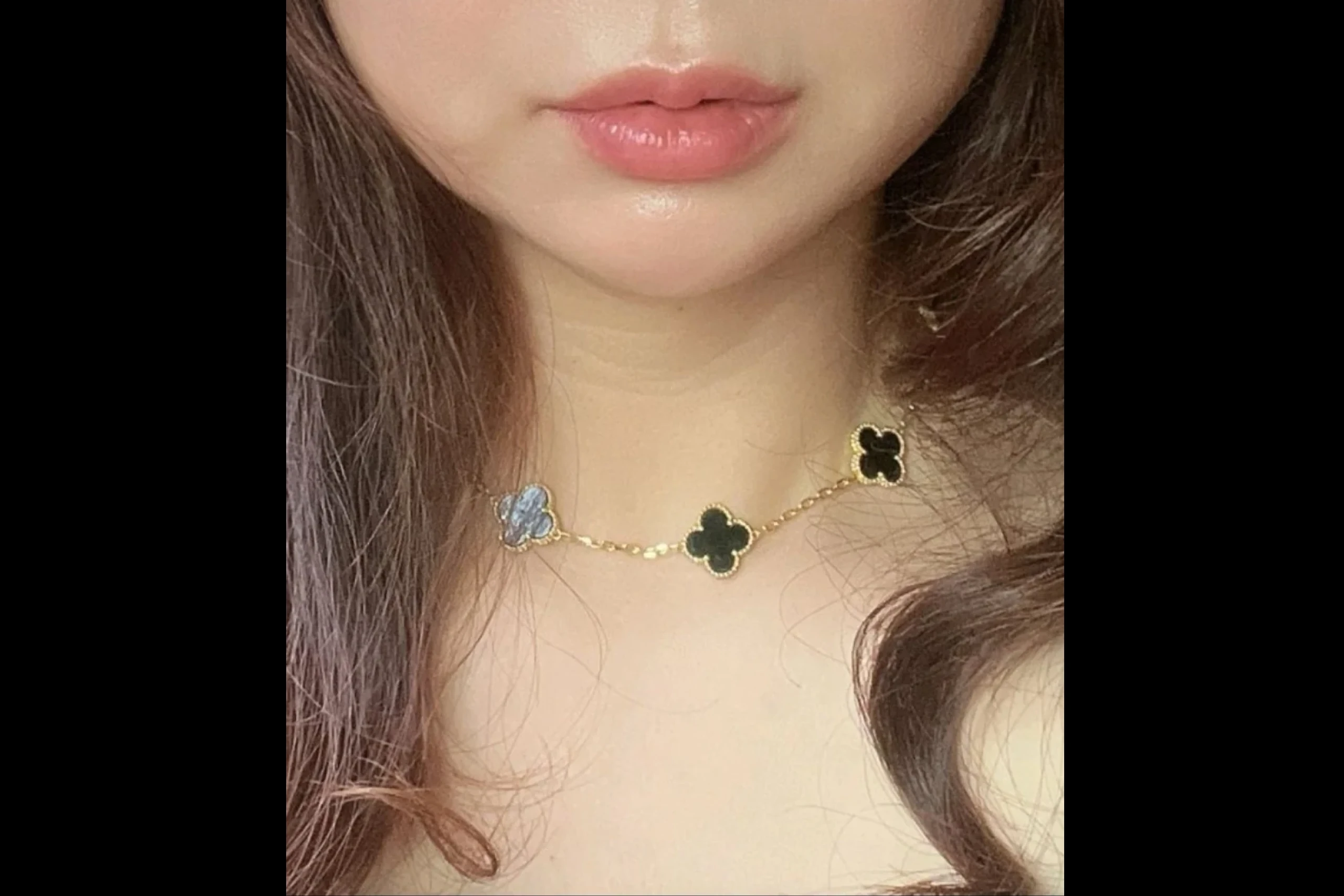 唇部填充前的Dr.Eraser