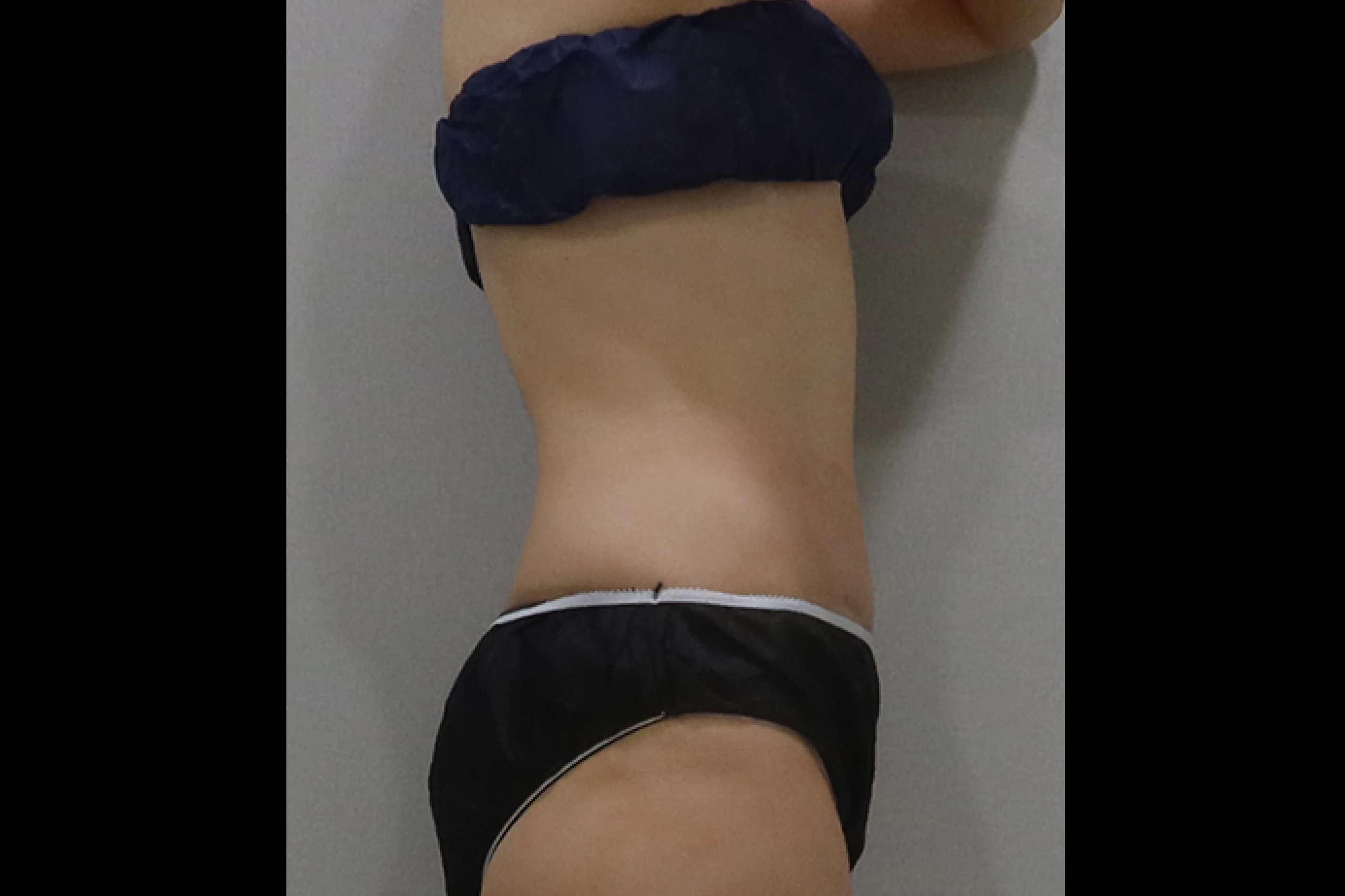 经过 Premium TuneBody 处理后的侧视图 03